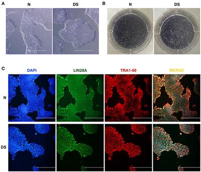 The Study of Alternative Splicing Events in Human Induced Pluripotent Stem Cells From a Down's Syndrome Patient